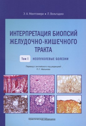 Интерпретация биопсий пищеварительного тракта. Том I. Неопухолевые болезни