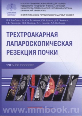 Трехтроакарная лапароскопическая резекция почки