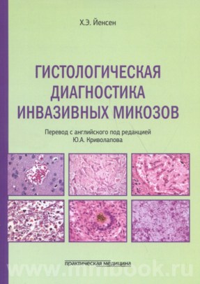 Гистологическая диагностика инвазивных микозов